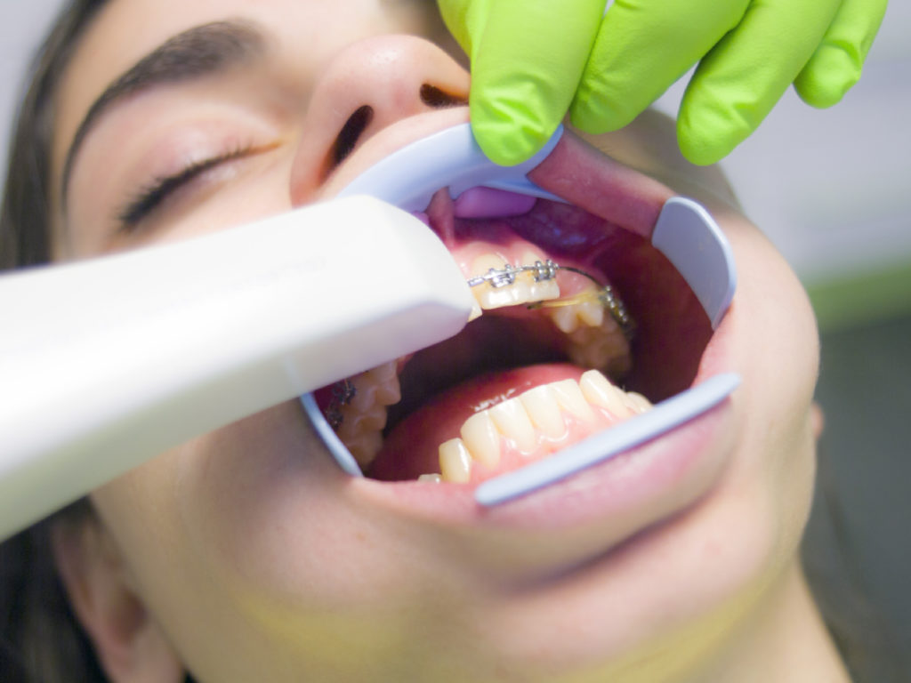 Dental Crown Malaysia